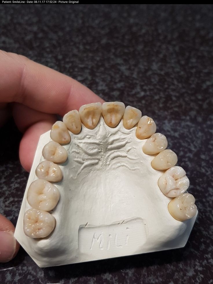 ARABIAN DENTAL LAB MANJERI