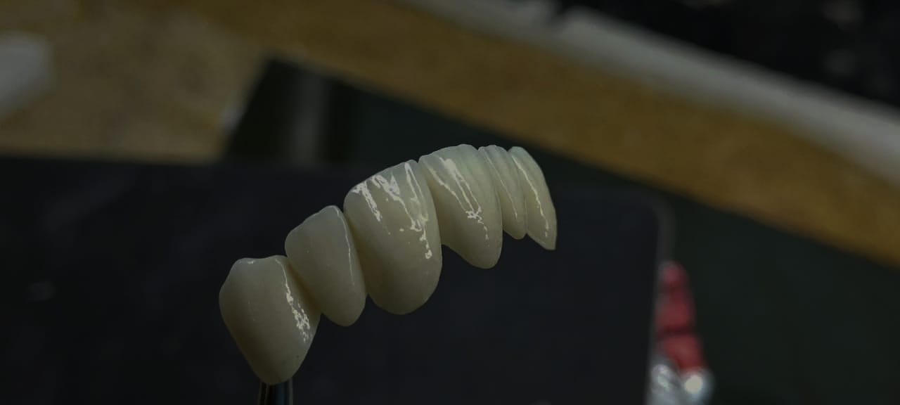 ARABIAN DENTAL LAB MANJERI